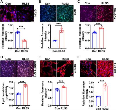 Ferroptosis due to Cystathionine γ Lyase/Hydrogen Sulfide Downregulation Under High Hydrostatic Pressure Exacerbates VSMC Dysfunction